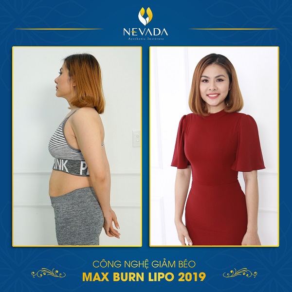 giảm béo bằng công nghệ max burn lipo có tái béo không, max burn lipo có tái béo không