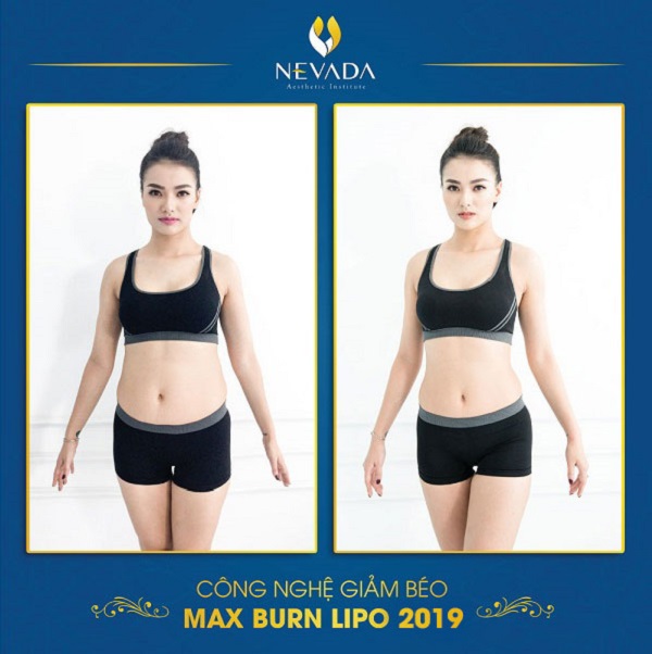 hình ảnh khách hàng trước và sau khi giảm béo Max Burn Lipo