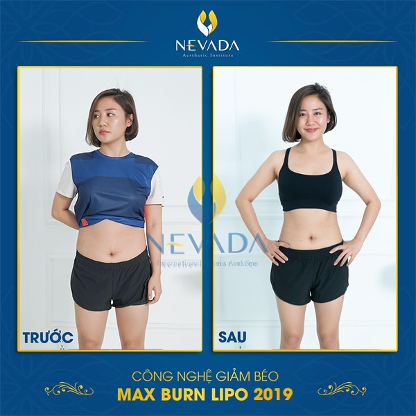 hình ảnh khách hàng trước và sau khi giảm béo Max Burn Lipo