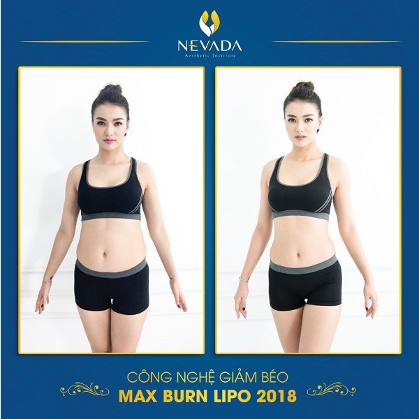 giảm béo Max Burn Lipo 2018