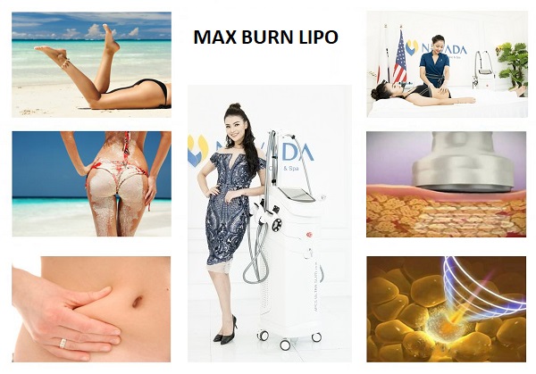Công nghệ giảm béo vùng mỡ bụng Max Burn Lipo là gì có tốt không