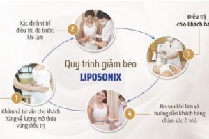 Giảm béo bằng công nghệ Liposonix có tốt không?