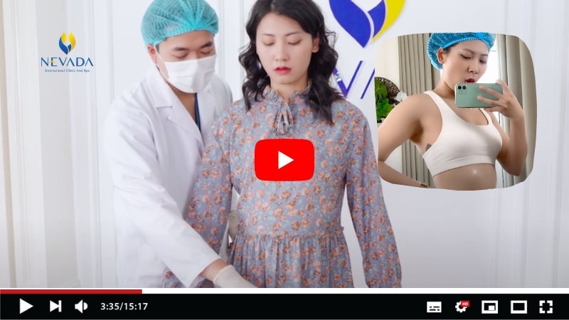 Bụng Bự Vlog: Vén màn sự thật công nghệ giảm béo 15-20 cm mỡ vòng bụng không cần phẫu thuật